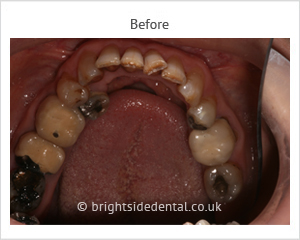 Restorative Dentistry Before2