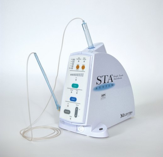 Introducing The Wand for Pain Free Dentistry