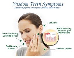 wisdom teeth
