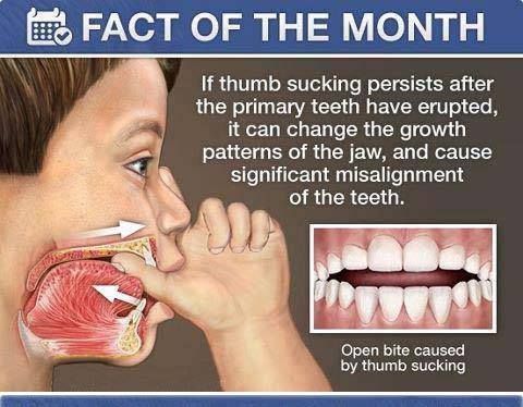 How To Stop Thumb Sucking
