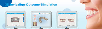 See How Your New Smile Could Look