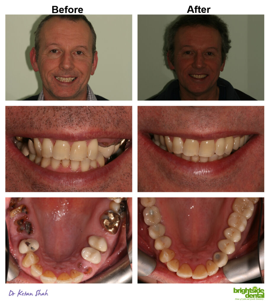 Brightside Dental Smile Of The Month March 2019
