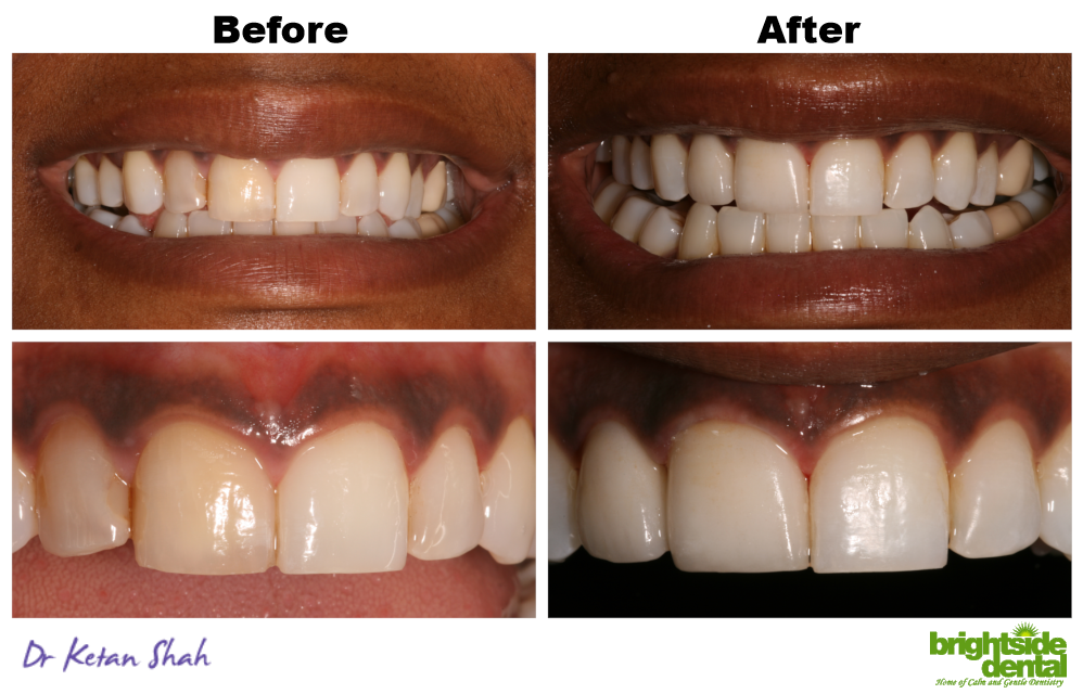 Brightside Dental Smile Of The Month April 2019