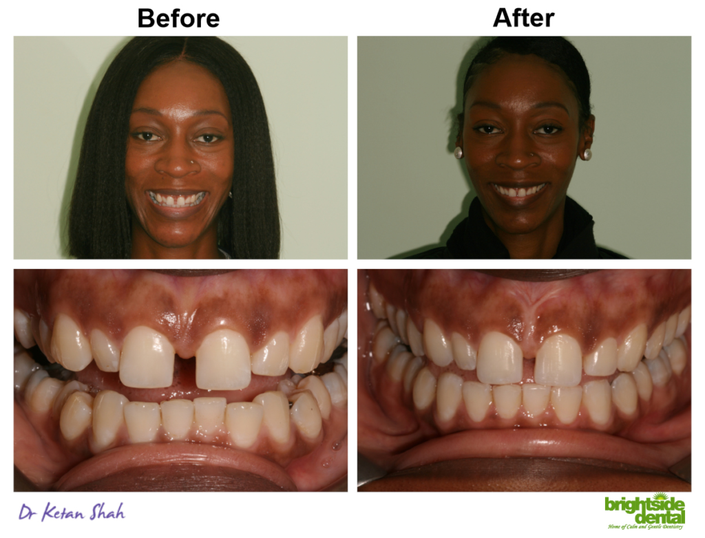 Brightside Dental Smile Of The Month May 2019