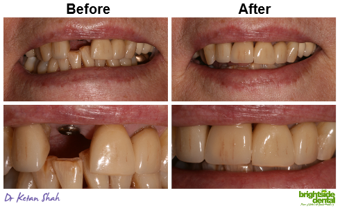 Brightside Dental Smile Of The Month June 2019