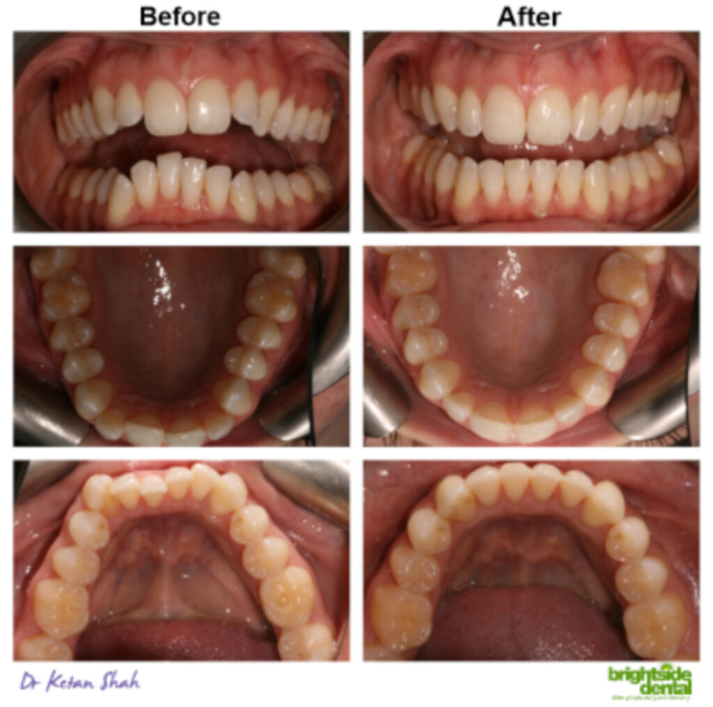Brightside Dental Smile Of The Month July 2019