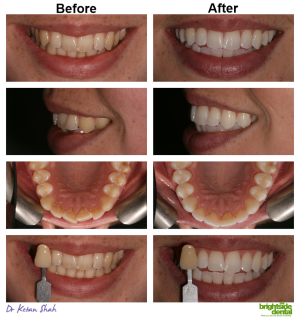 Brightside Smile Of The Month August 2019