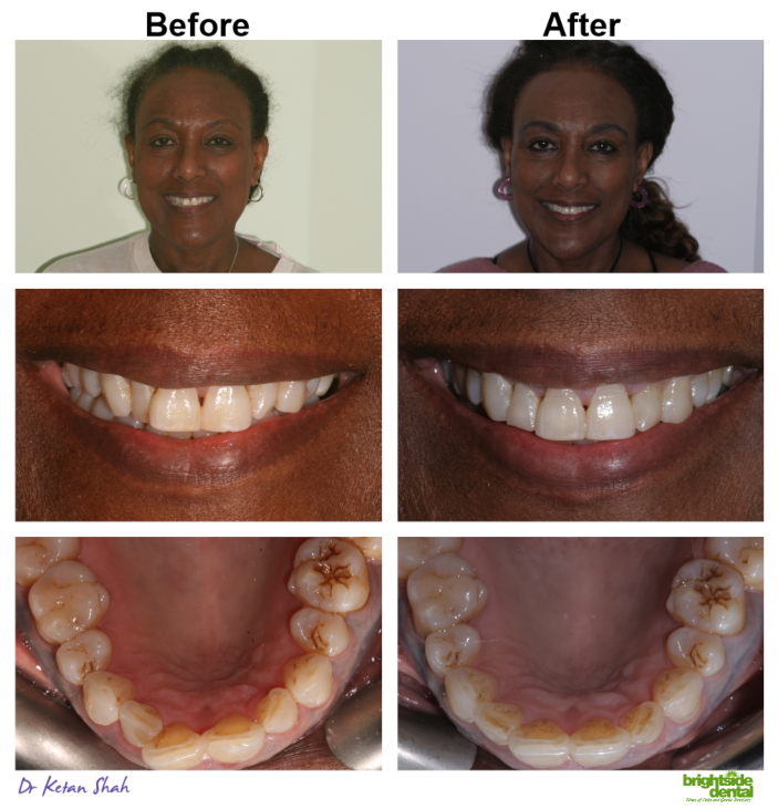 Brightside Smile of The Month January 2020