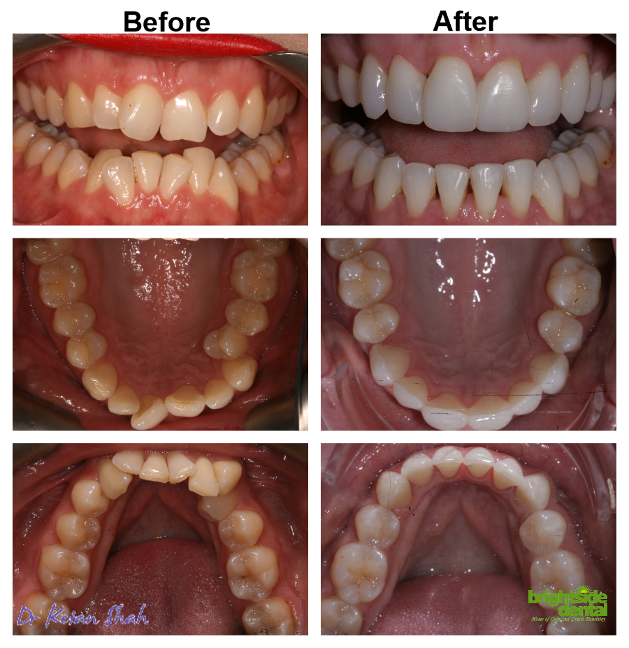Brightside Smile Of The Month March 2020