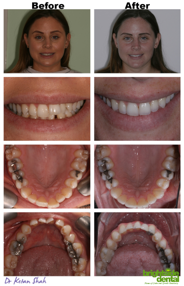 Brightside Smile Of The Month September 2020