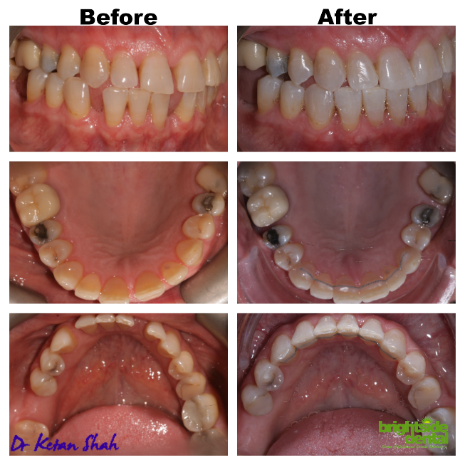 Brightside Smile Of The Month February 2021