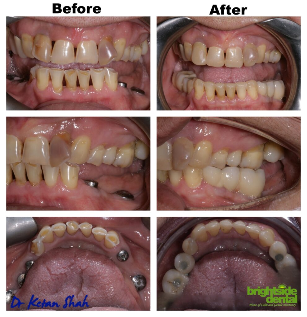Brightside Dental Smile Of The Month March 2021
