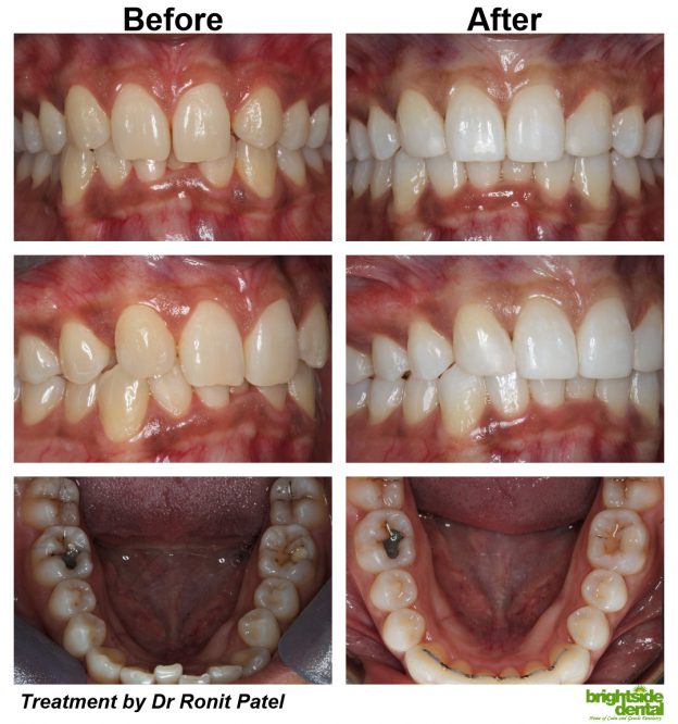 Brightside Dental – Smile Of The Month July 2021