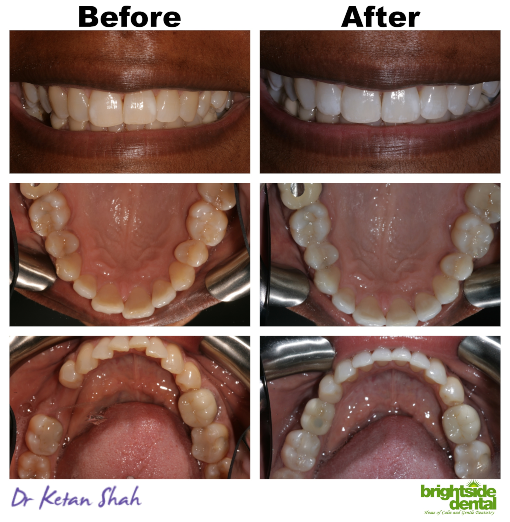Brightside Dental Smile Of The Month October 2021