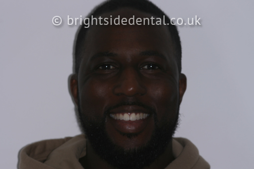 Smile Gallery