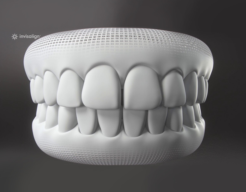 Invisalign