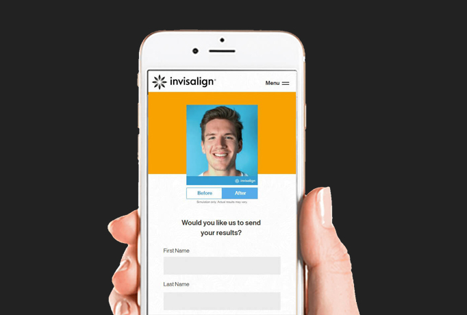 Invisalign Smile View