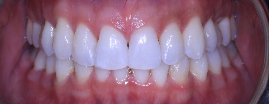 Smile of the Month – Wedding Smile Ready!