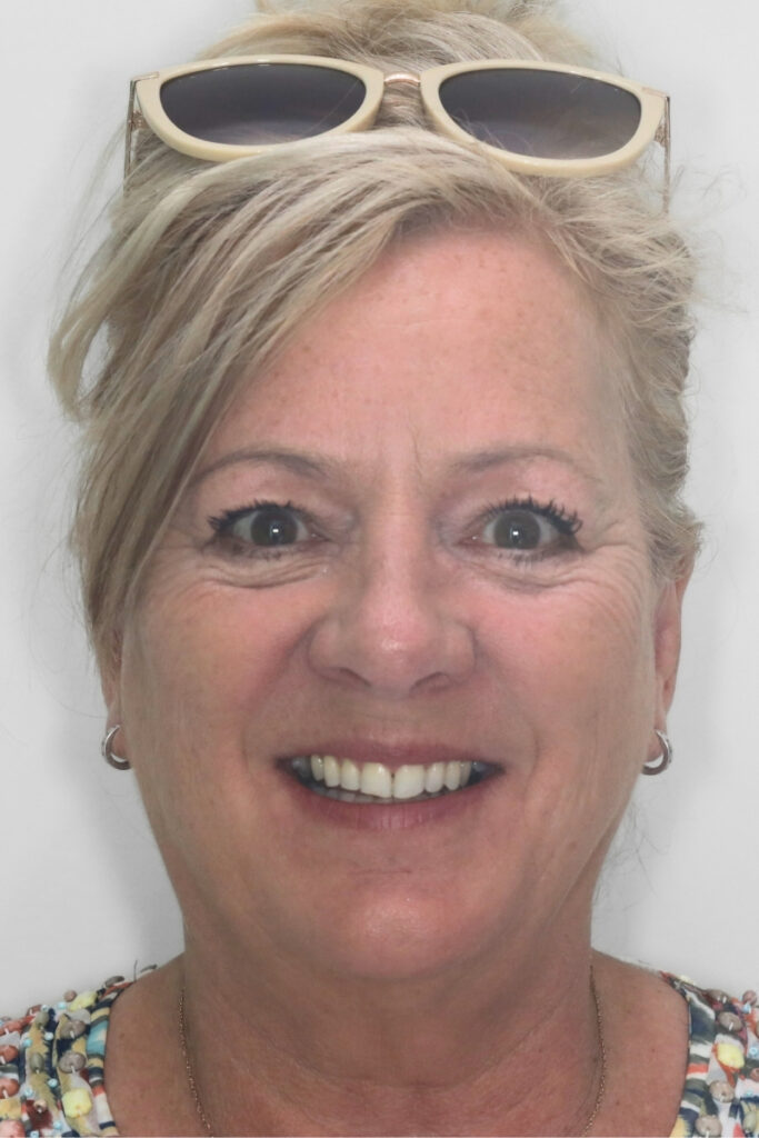 Invisalign Open Days – This October