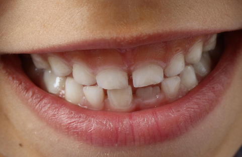 Doing it for the kids – children’s dentistry at Brightside