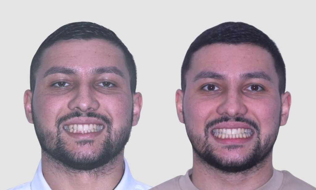 Smile of the Month – Simple Change, Big Difference